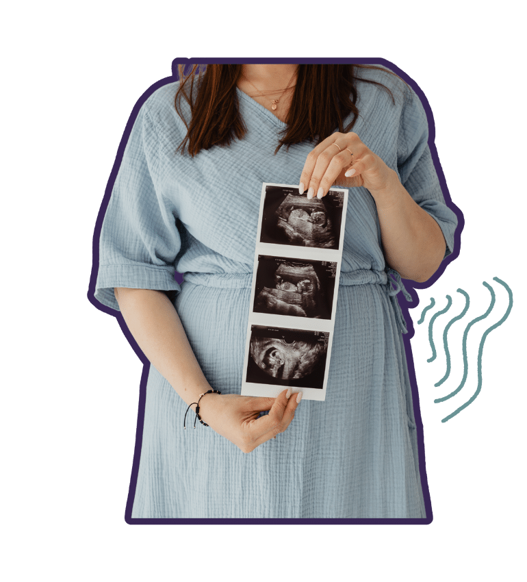 A woman in a blue dress holding ultrasound images