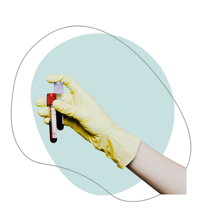 A hand with a yellow glove holding a test tube of blood